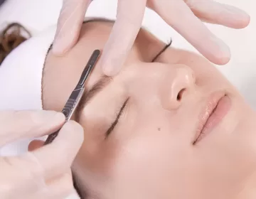 dermaplaning